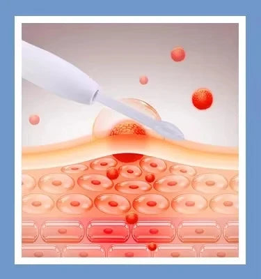 10 IN 1 MACCHINA COMPLETA PER LA PULZIA PROFONDA DEL VISO